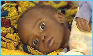 Starving child